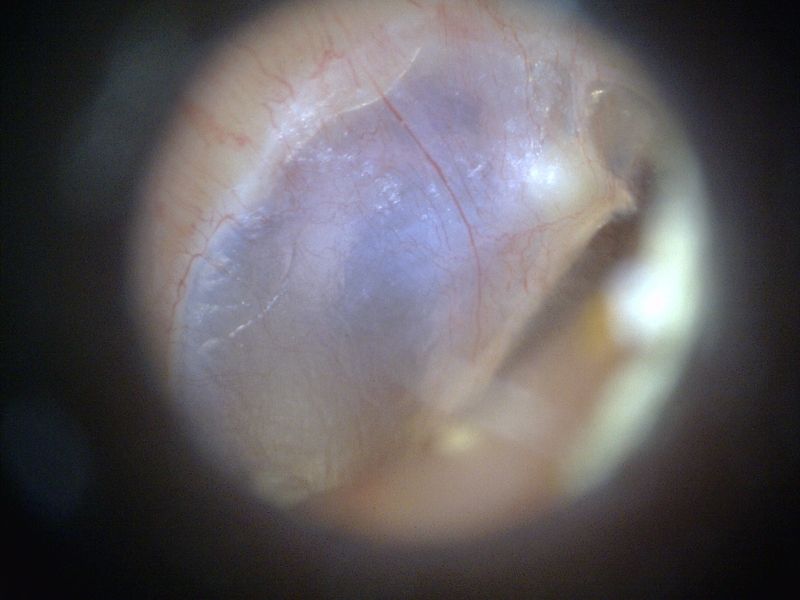 MEDL3E Dino-Lite EarScope Basic Digital Mikroskop