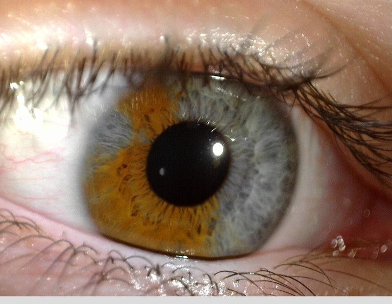 MEDL4R Dino-lite IriScope Digital Mikroskop