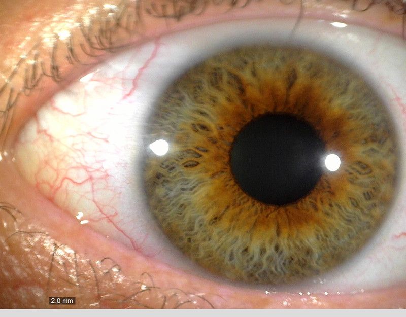 MEDL4R Dino-lite IriScope Digital Mikroskop