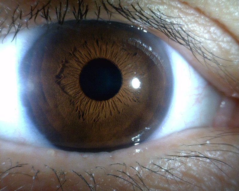 MEDL4R Dino-lite IriScope Digital Mikroskop