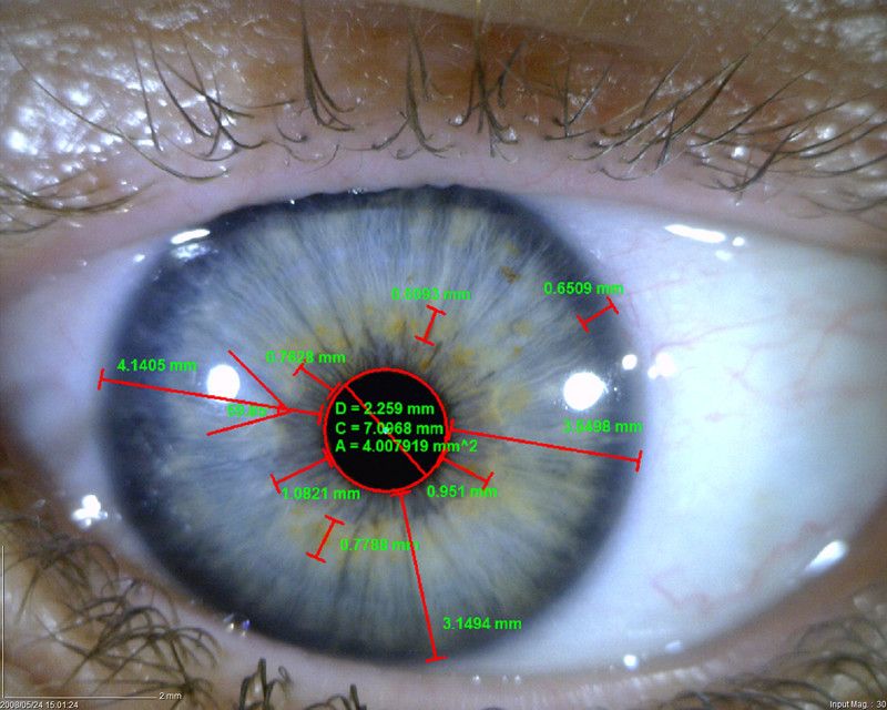 MEDL4R Dino-lite IriScope Digital Mikroskop