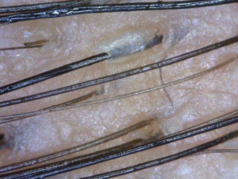 MEDL7HM Dino-Lite TrichoScope Polarizer HR