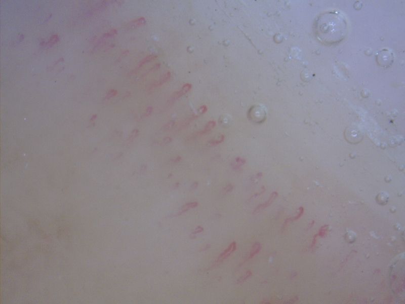 MEDL4N5 Dino-Lite CapillaryScope 500 Pro Digital Mikroskop