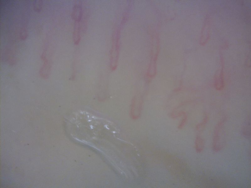 MEDL4N Dino-Lite Pro Capillary Scope 200 Digital Mikroskop 