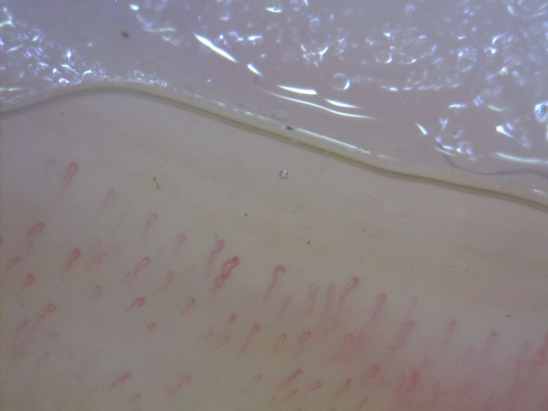 MEDL4N Dino-Lite Pro Capillary Scope 200 Digital Mikroskop 