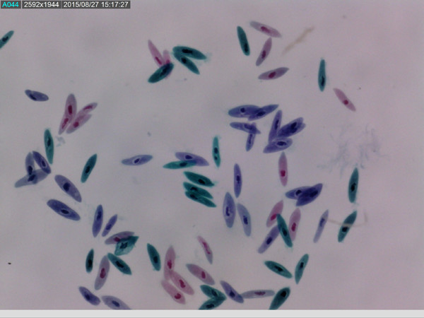 Dino-Lite AM7515-MZTL Edge Digital USB Mikroskop Long