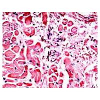 SOIF BK5000-TR/L Trinoküler Laboratuar Araştırma Mikroskobu - IOS Plan Achromat 