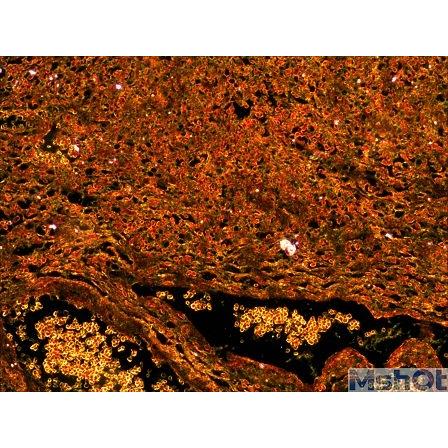 MD 50 5.0 MP CMOS Mikroskop Görüntüsü Transfer Kamerası ve Yazılımı