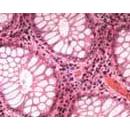 SOIF BK-FL2 Model Trinoküler Flerosan Ataçmanlı Araştırma Mikroskobu