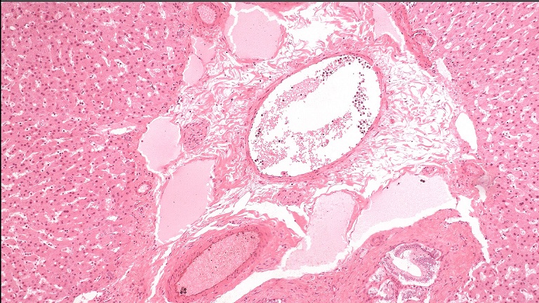 MD80-HD 4K HDMI CMOS Mikroskop Görüntüsü Transfer Kamerası ve Yazılımı