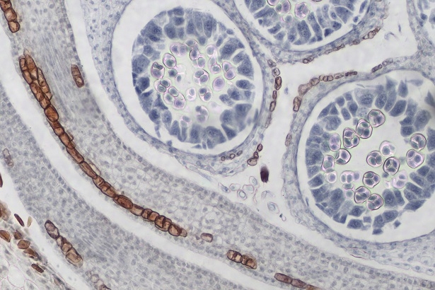 MD 60 6.3 MP CMOS Mikroskop Görüntüsü Transfer Kamerası ve Yazılımı