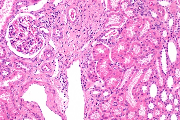 MD 60 6.3 MP CMOS Mikroskop Görüntüsü Transfer Kamerası ve Yazılımı