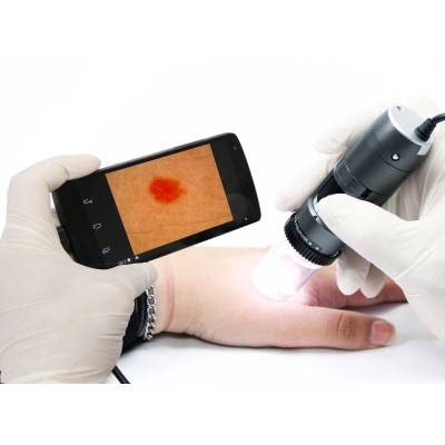 MEDL4DW Dino-Lite DermaScope Polarizer