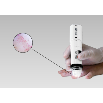 MEDLW4N PRO Dino-Lite CapillaryScope 200 Pro Wireless