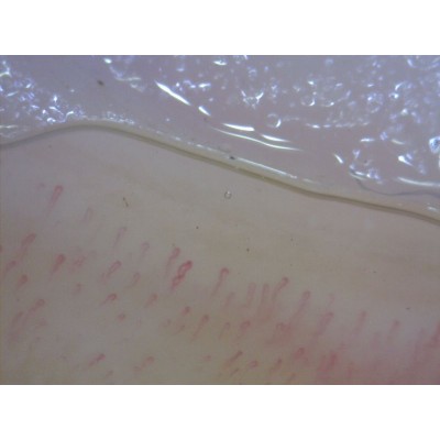 MEDLW4N5 PRO Dino-Lite CapillaryScope 500 Pro Wireless