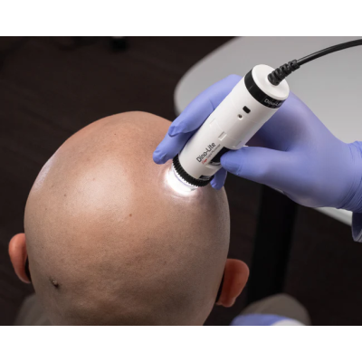 MEDLW4-HM Dino-Lite TrichoScope Polarizer Wireless