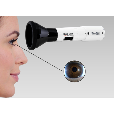 MEDLW4R Dino-Lite IriScope Wireless