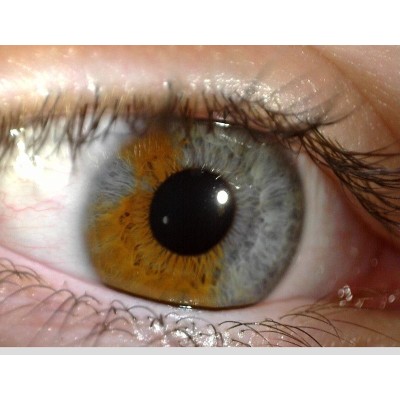 MEDLW4R Dino-Lite IriScope Wireless