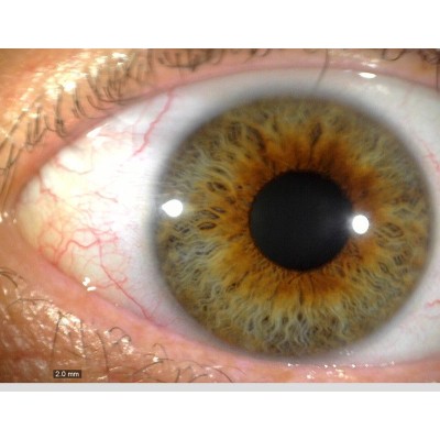 MEDLW4R Dino-Lite IriScope Wireless