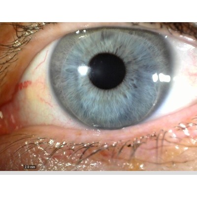 MEDLW4R Dino-Lite IriScope Wireless