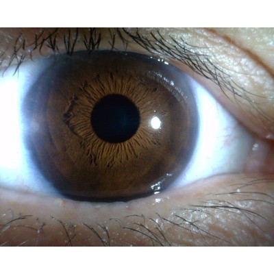 MEDLW4R Dino-Lite IriScope Wireless